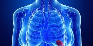 How to Treat an Enlarged Spleen Naturally