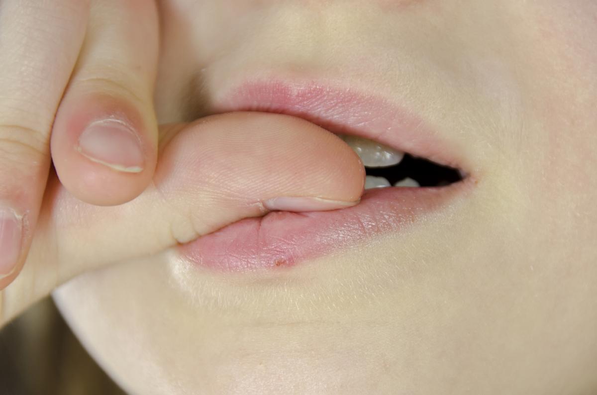 Home Remedies to Stop Biting Your Nails