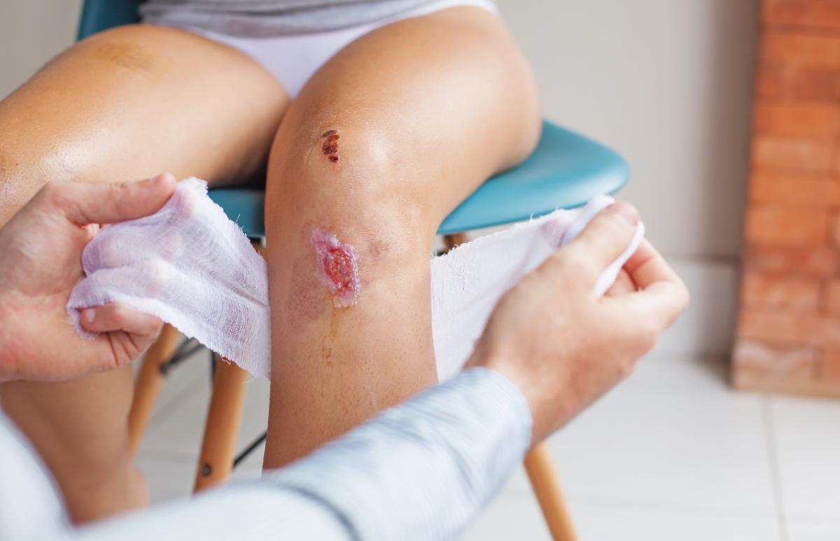 Why is my Wound Turning White? All Possible Reasons