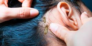 What Does It Mean When You Dream of Lice?