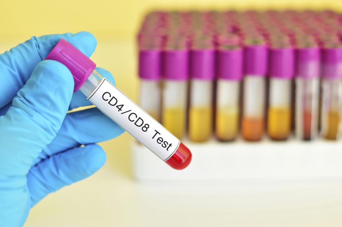 How to Lower High Lymphocytes