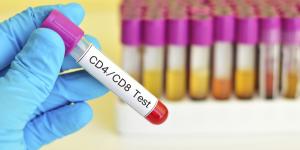 How to Lower High Lymphocytes