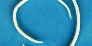 How to get rid of pinworms naturally