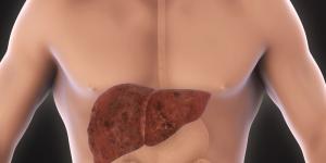 Home Remedies for an Enlarged Liver