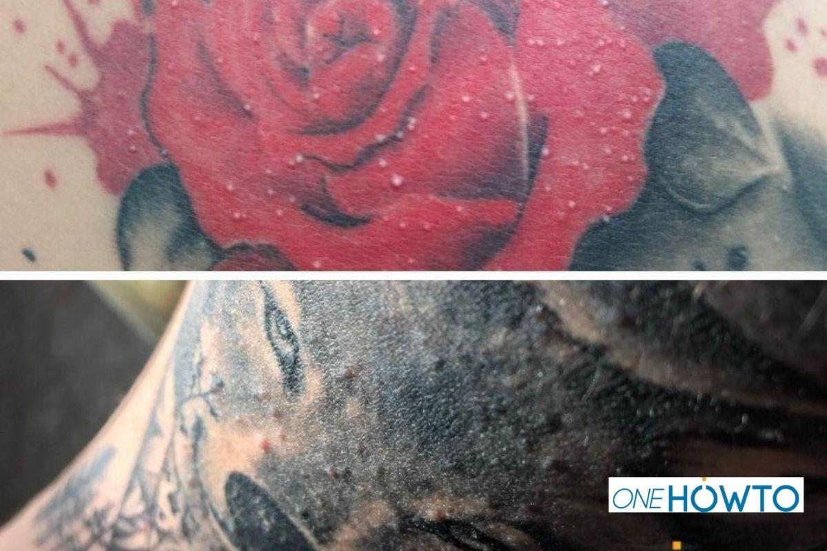 Why Do I have Bumps on My Tattoo?