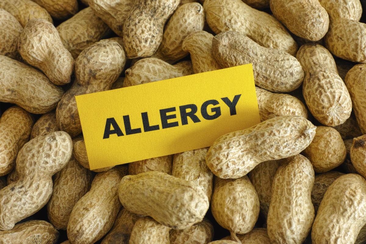 How to Know if my Child is Allergic to Peanut Butter