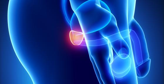 The Best Herbal Tea for Prostate Health