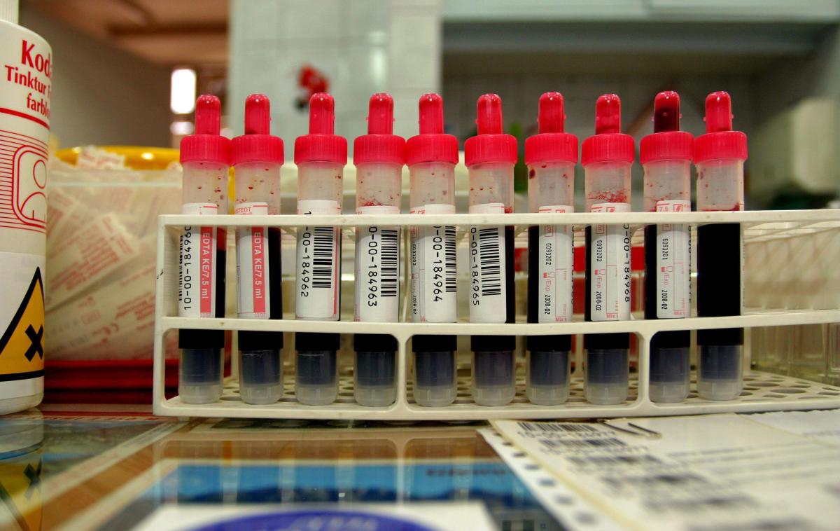 What Are the Causes of low Alkaline Phosphatase?