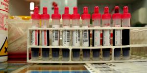 What Are the Causes of low Alkaline Phosphatase?